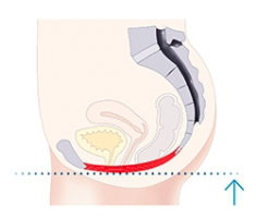 pelvic floor